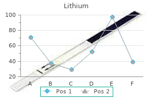 buy generic lithium 150 mg online