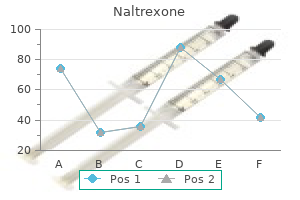 cheap 50 mg naltrexone amex